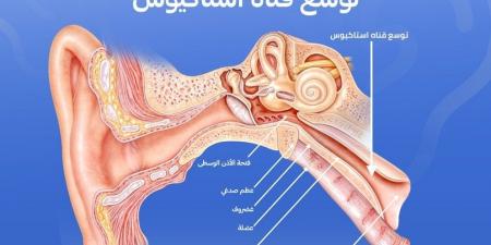 كيف نمنع تطور التهاب الأذن الوسطى أثناء نزلات البرد؟