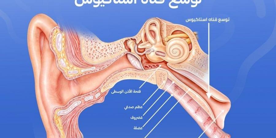 كيف نمنع تطور التهاب الأذن الوسطى أثناء نزلات البرد؟