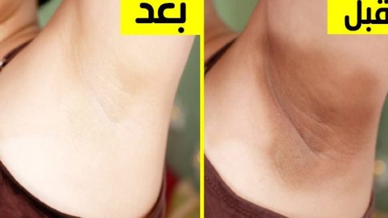 وداعًا للمعاناة.. وصفة طبيعية مدهشة لتفتيح المناطق الحساسة في وقت قياسي 5 وداعًا للمعاناة.. وصفة طبيعية مدهشة لتفتيح المناطق الحساسة في وقت قياسي