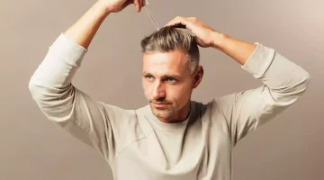 5 أخطاء عند استعمال المينوكسيديل- علاج الصلع