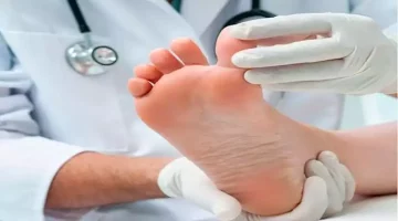 فطريات القدم السكري.. إليك الأسباب وطرق العلاج