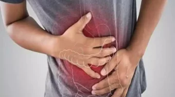كيف تؤثر الأطعمة الحارة على مرضى جرثومة المعدة؟