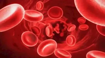 كيف تحمي نفسك من فقر الدم الناتج عن نقص B12؟