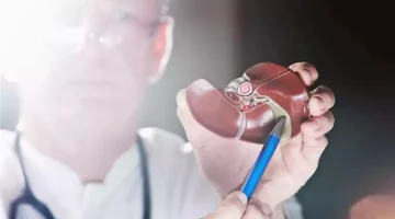طبيب يوضح أسباب نقص العصارة الصفراوية- أبرزها تليف الكبد