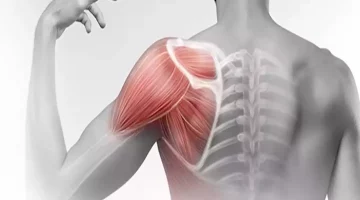 تعسر الكتف أثناء الولادة ،الأسباب والأعراض وطرق العلاج