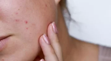 حبوب الدورة الشهرية والحمل- ما الفرق بينهما؟