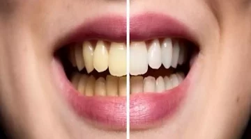 ابتسامتك سر ثقتك.. طرق منزلية للحفاظ على أسنانك بيضاء بالشتاء