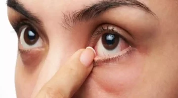 7 علامات في العين تدل على صحة الأمعاء