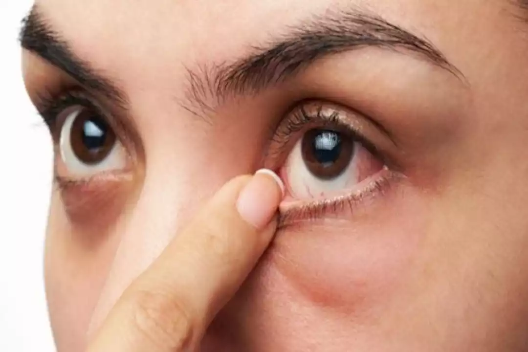7 علامات في العين تدل على صحة الأمعاء