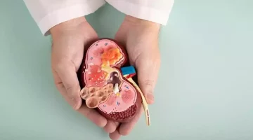 للحفاظ على كليتيك- 7 عادات صباحية لا غنى عنها