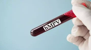 للوقاية من فيروس HMPV- خبير تغذية يوصي بتناول هذه الأطعمة