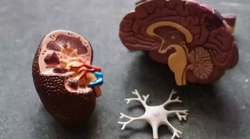 للوقاية من تليف الكلى- 5 أطعمة أضفها لنظامك الغذائي