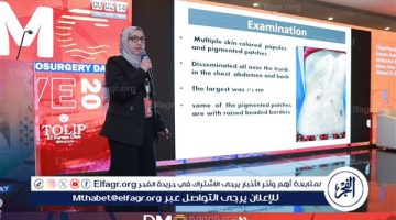 صحة الدقهلية:”الجلدية والجذام ” تحصد المركز الأول بمؤتمر “ديرما ماستر كلينك”