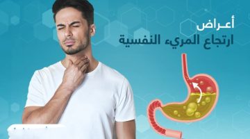 “كل ما تحتاج معرفته عن ارتجاع المريء: الأسباب، الأعراض وطرق العلاج الفعالة”