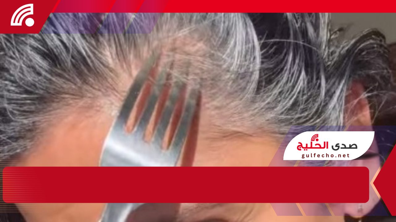 "هل يمكن لشوكة الطعام أن تُزيل الشيب وتُعيد شباب الشعر؟ الحقيقة وراء هذا الترند الغريب" 5 “هل يمكن لشوكة الطعام أن تُزيل الشيب وتُعيد شباب الشعر؟ الحقيقة وراء هذا الترند الغريب”
