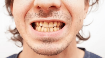 الشاي والقهوة أم الكوكاكولا.. أي هذه المشروبات يغيّر لون الأسنان أكثر؟