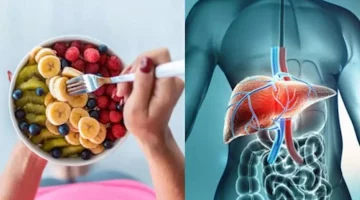 علاج الكبد الدهني- 7 فواكه قد تساعدك على الشفاء منه