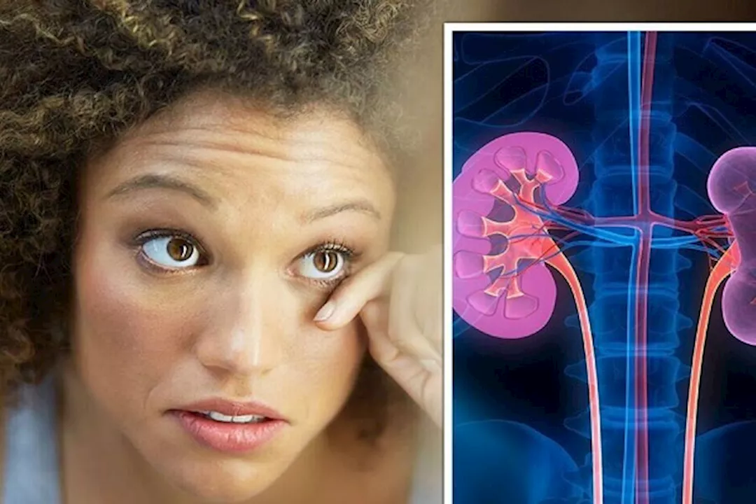 أعراض تلف الكلى في العين 5 أعراض تلف الكلى في العين