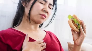 علاج ارتجاع المريء- حسام موافي يوضح بديل التدخل الجراحي