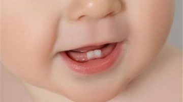 3 علامات مهمة تشير لتسنين الأطفال