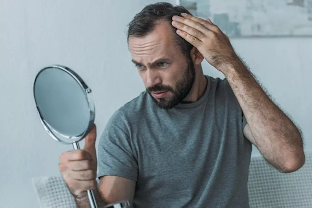 أعراض نقص فيتامين د في البشرة والشعر 5 أعراض نقص فيتامين د في البشرة والشعر