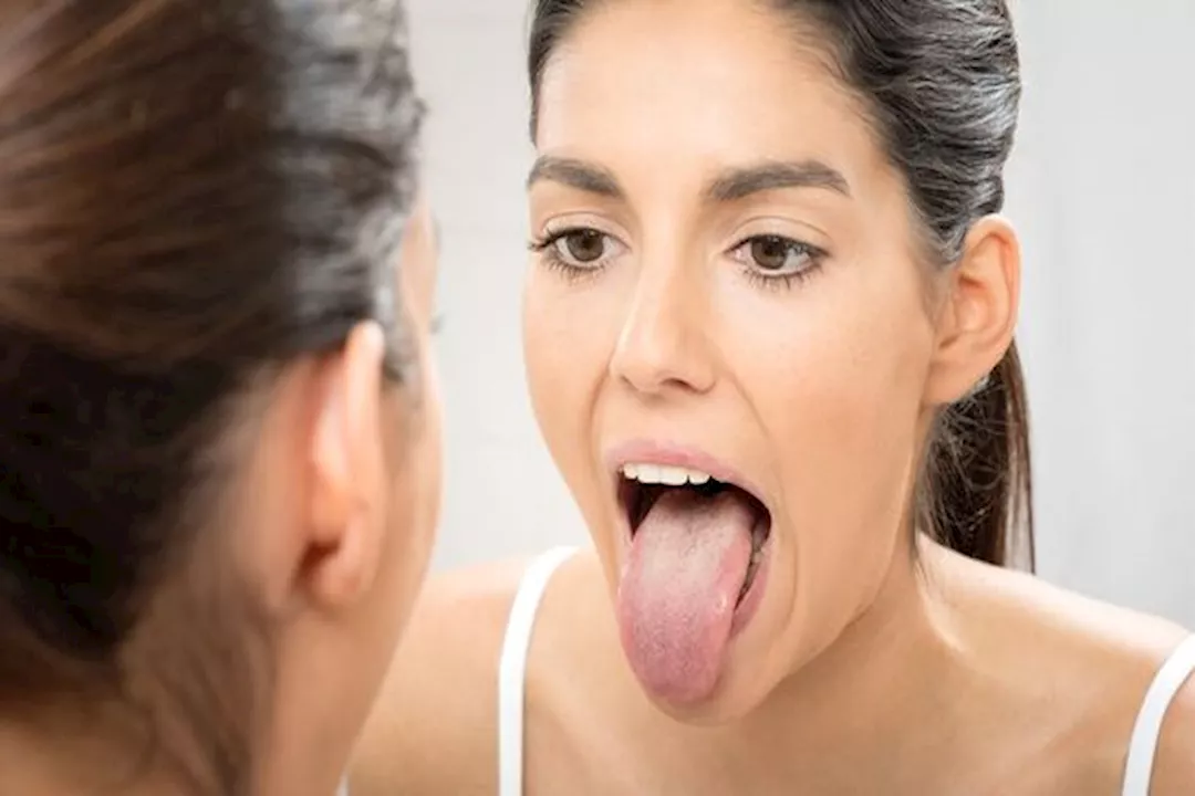 احذر ظهور هذه العلامات على اللسان بعد شرب القهوة 5 احذر ظهور هذه العلامات على اللسان بعد شرب القهوة