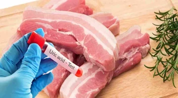 لمرضى النقرس.. اتبع هذه النصائح في عيد الأضحى