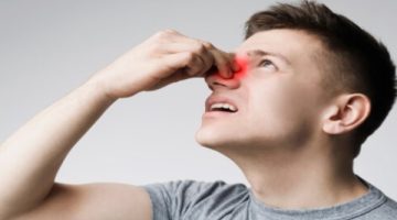 اكتشف علاج نزيف الأنف وعلامات الخطر